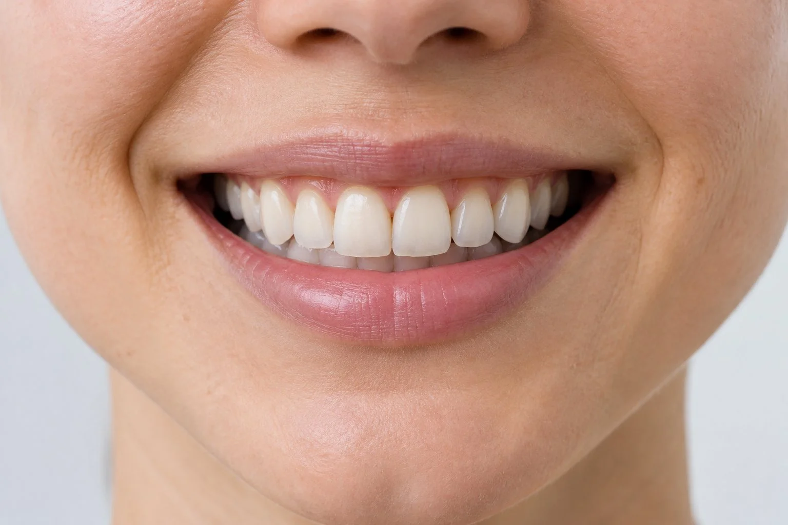 natural-looking teeth illustrating surface stain removal and tooth whitening.